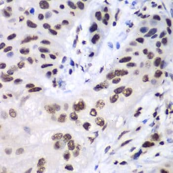 LIG3 / DNA Ligase III Antibody
