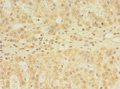 YKT6 Antibody