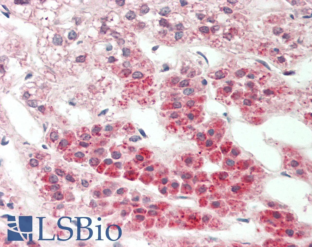 Polyclonal Rabbit anti-Human Nor-1 / NR4A3 Antibody (aa351-400, IHC, WB)