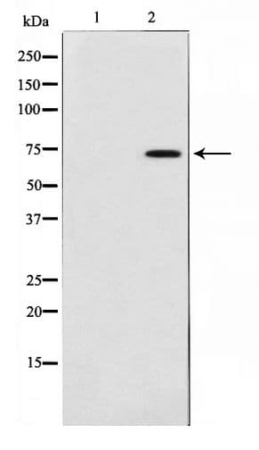 IRAK3 / IRAKM / IRAK-M Antibody