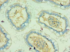 Polyclonal Rabbit anti-Human TRAF5 Antibody (aa1-300, IHC)