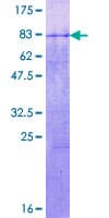 Human FBXL17 Protein (Recombinant GST)