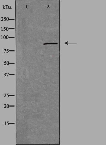 PRKG2 / CGKII Antibody