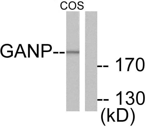 IHC-plus™ MCM3AP / GANP Antibody (aa1841-1890)