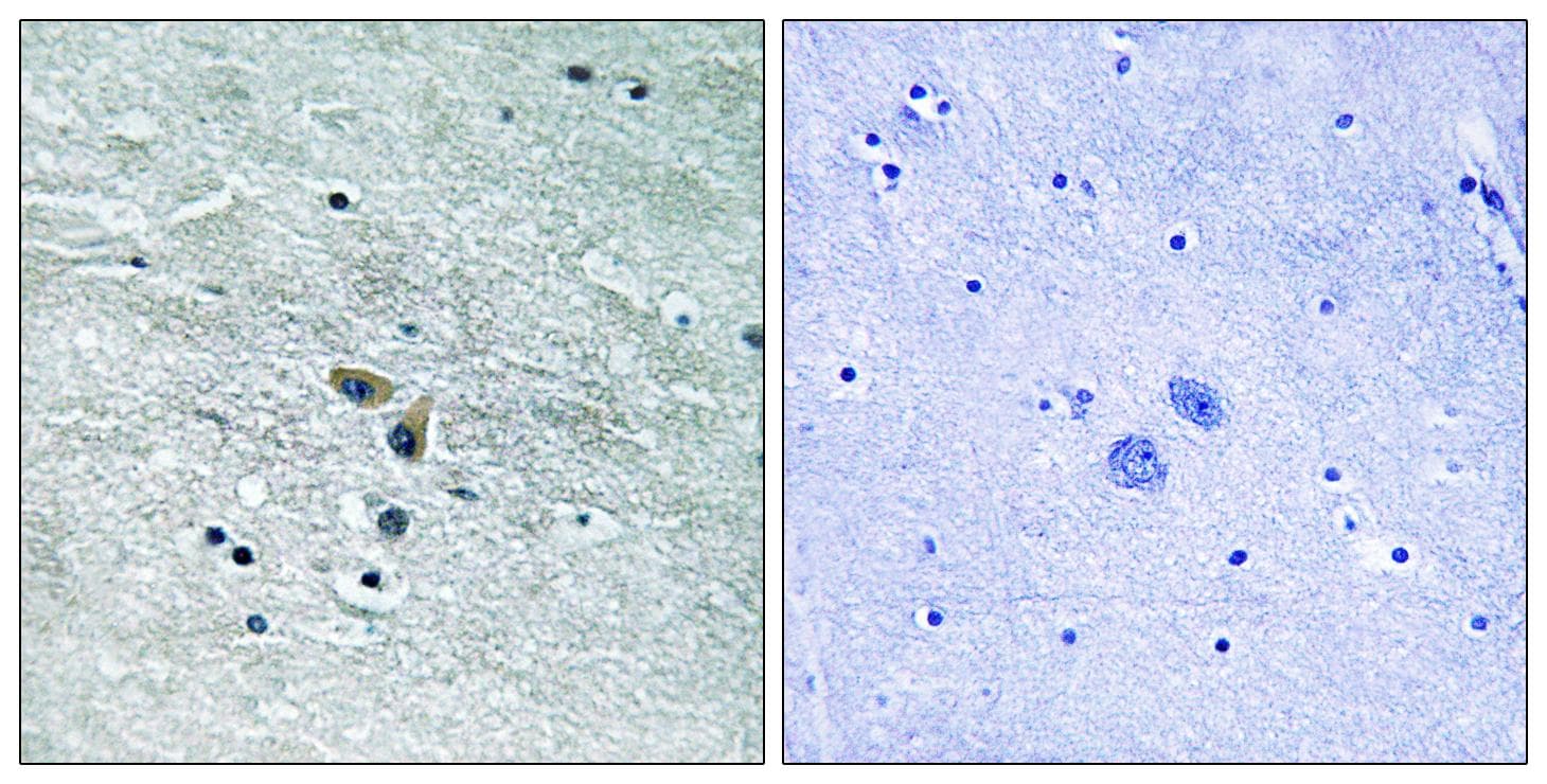 Polyclonal Rabbit anti-Human MAP3K8 / TPL2 Antibody (p400, IHC, WB)