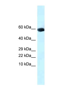 GDF10 / BMP3B Antibody (aa261-310)