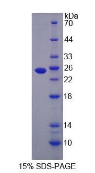 Human LMP2 Protein (Recombinant His-T7, N-terminus)