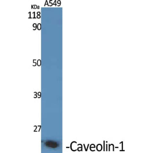 Polyclonal Rabbit anti-Human CAV1 / Caveolin 1 Antibody (100-180 aa, C-terminal, IF, WB)