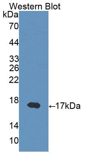IFN Gamma / Interferon Gamma Antibody