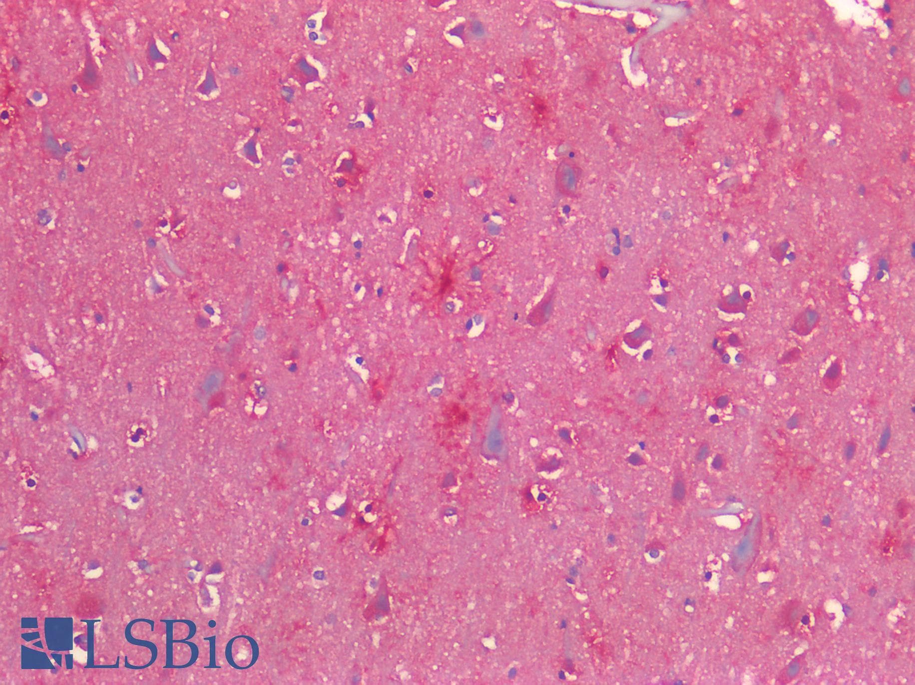 PathPlus™ CALCRL / CGRP Receptor Antibody (Cytoplasmic Domain)