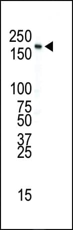 INSR / Insulin Receptor Antibody (aa21-52)
