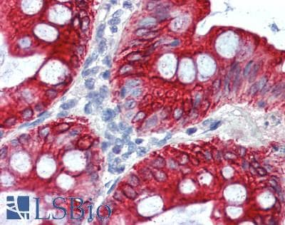 IHC-plus™ SLC16A7 / MCT2 Antibody