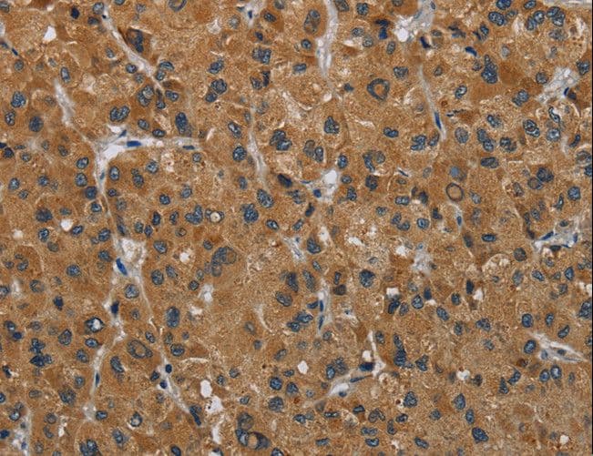 HSD3B7 Antibody