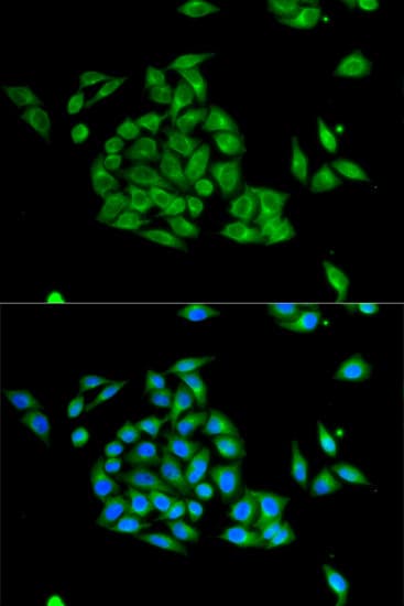 PICK1 Antibody