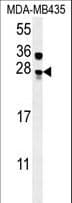 Polyclonal Rabbit anti-Human MUTED Antibody (aa40-68, IHC, WB)