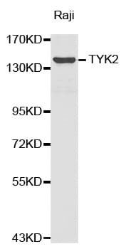 Polyclonal Rabbit anti-Human TYK2 Antibody (WB)