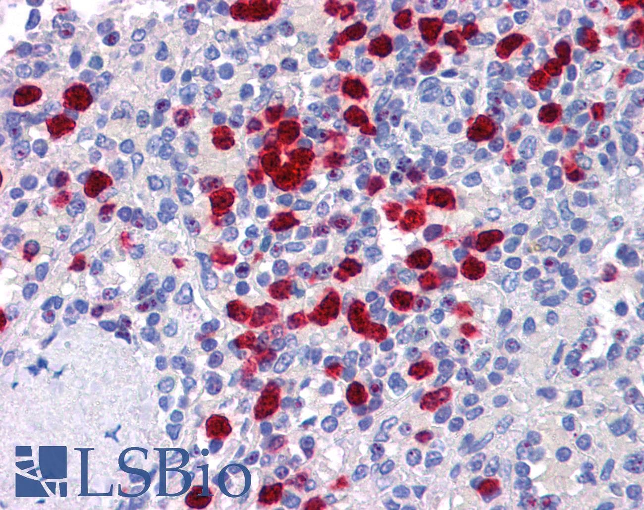 IHC-plus™ NLRP7 / NALP7 Antibody
