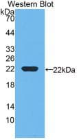 GC / Vitamin D-Binding Protein Antibody (clone C1, APC)