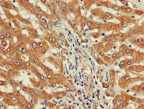 Polyclonal Rabbit anti-Human DEPDC1B Antibody (IHC, IF, WB)