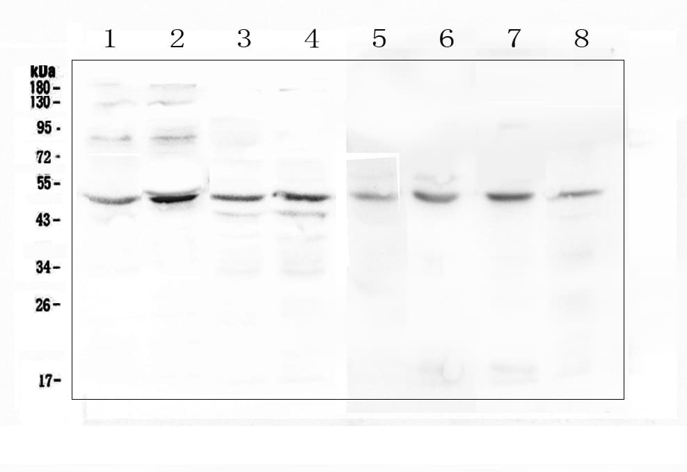 KCNN4 / KCa3.1 Antibody