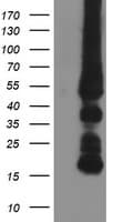 GATM / AGAT Antibody (clone OTI1E3, Carrier-free)