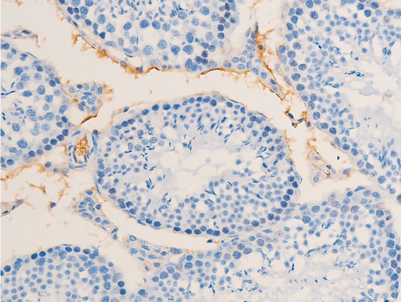 Polyclonal Rabbit anti-Human ERBB2 / HER2 Antibody (phospho-Tyr1112, IHC, IF, WB)