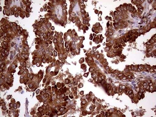 RRBP1 / hES Antibody (aa484-590, clone OTI3F1)