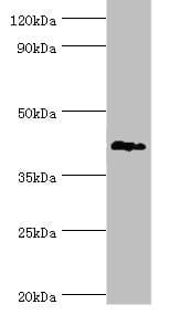 TDG / Thymine DNA Glycosylase Antibody (aa141-410)