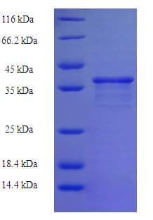 Human ZNF26 Protein (Recombinant His-SUMO)