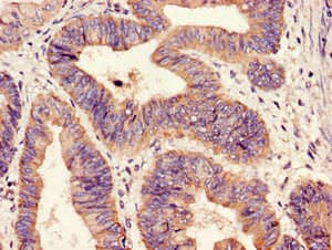 HIPK3 / FIST Antibody