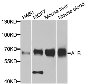 ALB / Serum Albumin Antibody