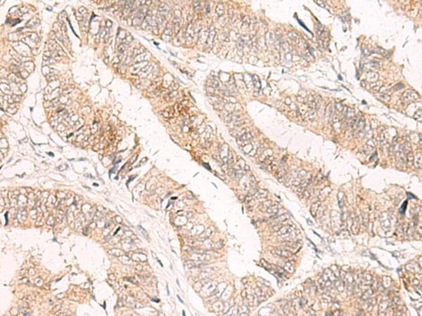 Polyclonal Rabbit anti-Human TRAPPC1 / MUM2 Antibody (IHC)