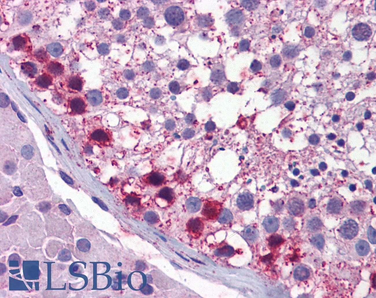 IHC-plus™ Polyclonal Rabbit anti-Human HIF1A / HIF1 Alpha Antibody (IHC, WB)
