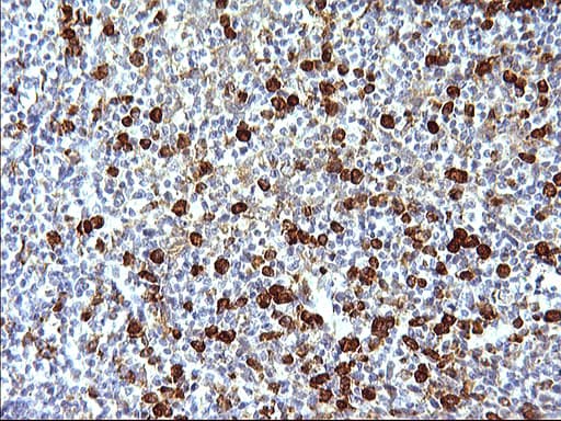 Monoclonal Mouse anti-Human FNDC8 Antibody (clone OTI1C12, IHC, WB)