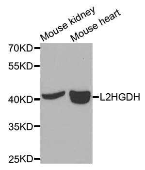 Polyclonal Rabbit anti-Human L2HGDH Antibody (IHC, WB)