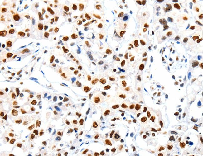 HDAC1 Antibody
