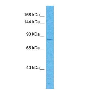 ZMYND8 / RACK7 Antibody (C-Terminus)