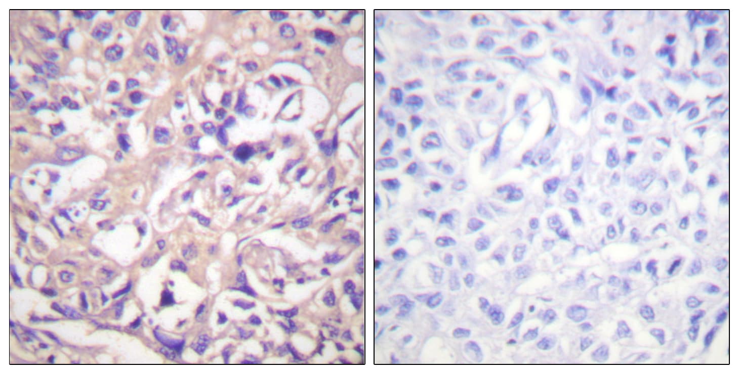 Polyclonal Rabbit anti-Human TK1 / TK / Thymidine Kinase Antibody (aa1-50, IHC, IF, WB)