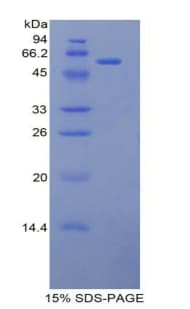 Mouse L1CAM Protein (Recombinant His-GST)