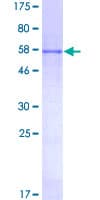 Human PRKAB2 / AMPK Beta 2 Protein (Recombinant GST)
