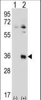 Polyclonal Rabbit anti-Human TSSK6 Antibody (aa25-54, IHC, WB)