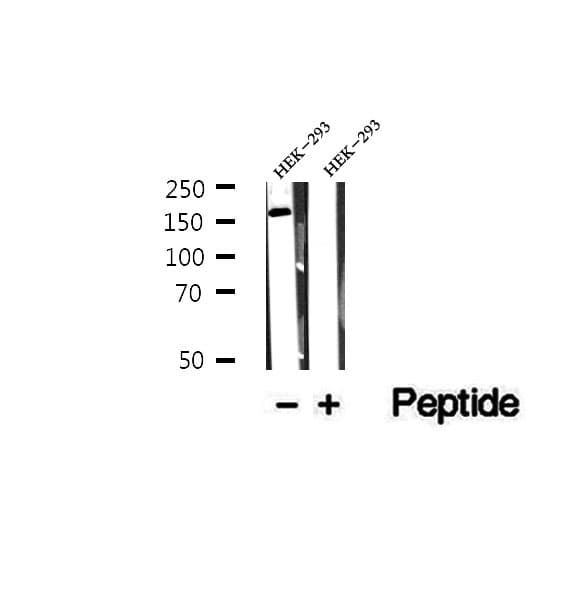 Polyclonal Rabbit anti-Human CEP164 Antibody (IHC, WB)