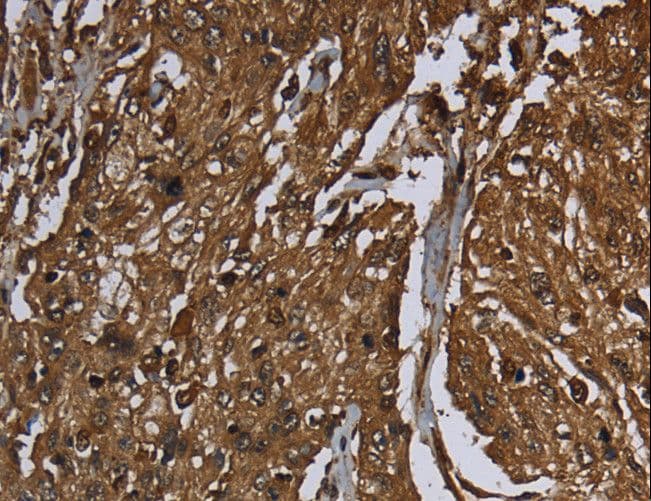 ARHGDIA / RHOGDI Antibody