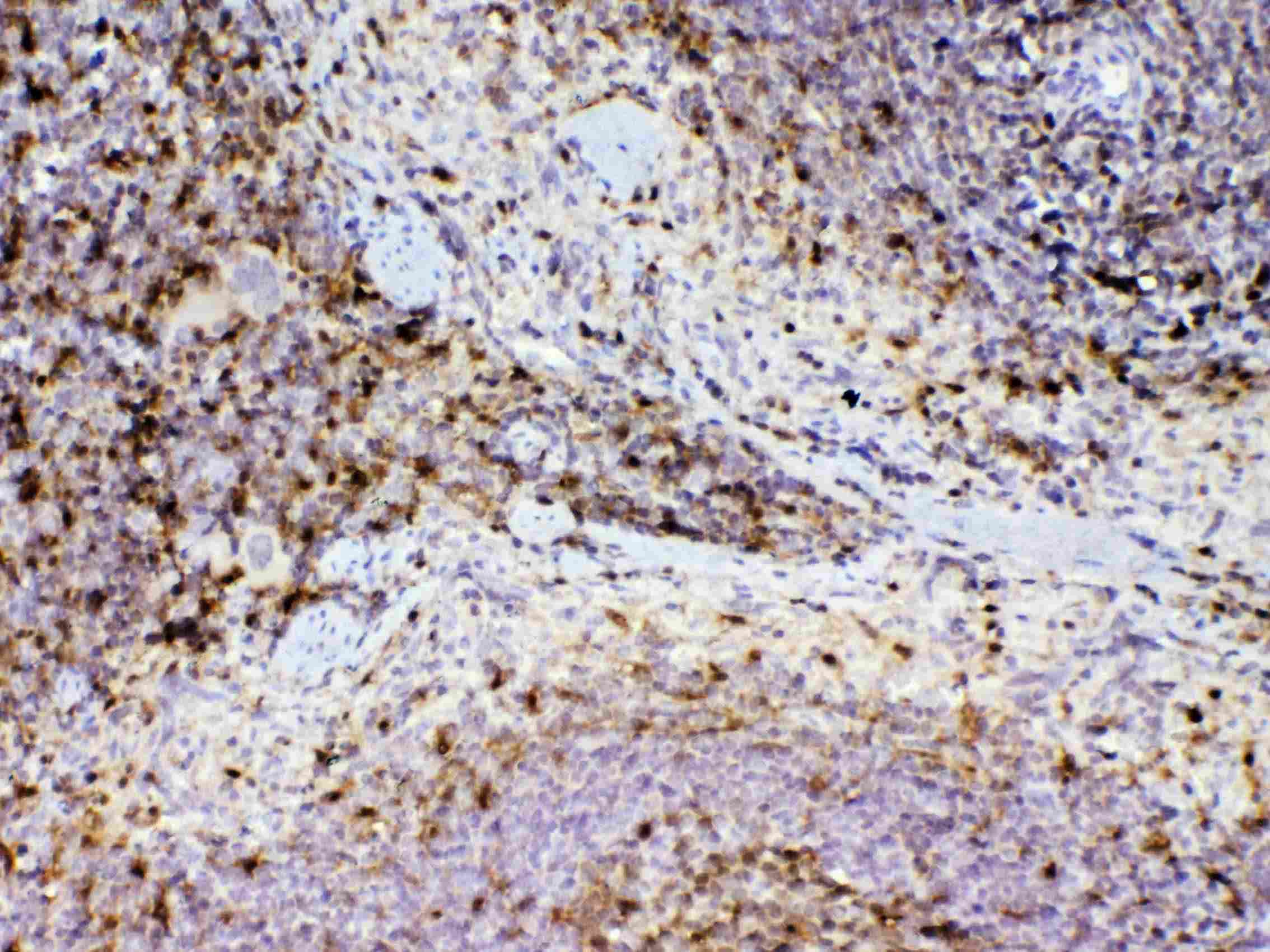 ADA / Adenosine Deaminase Antibody