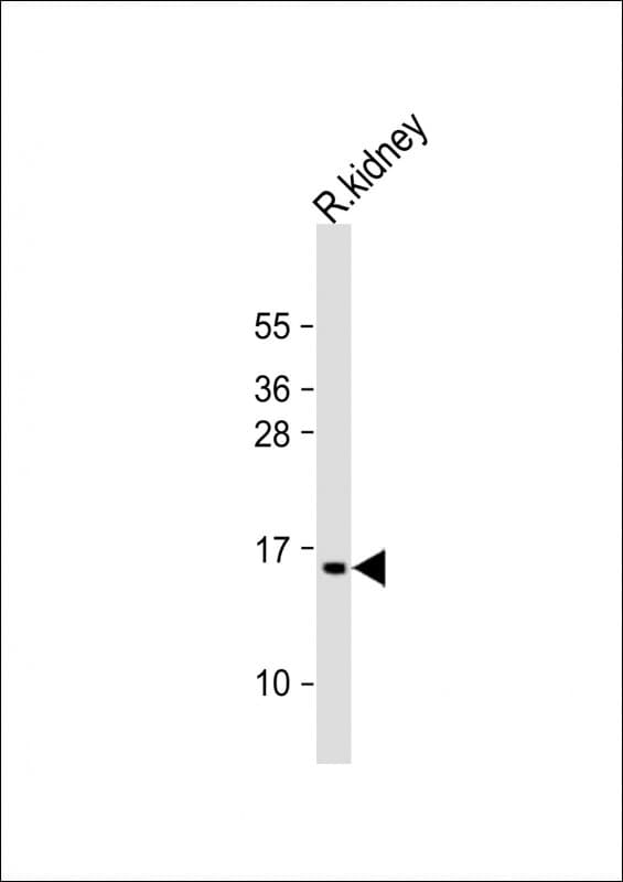 Polyclonal Rabbit anti-Human ATP5G3 Antibody (aa12-42, WB)