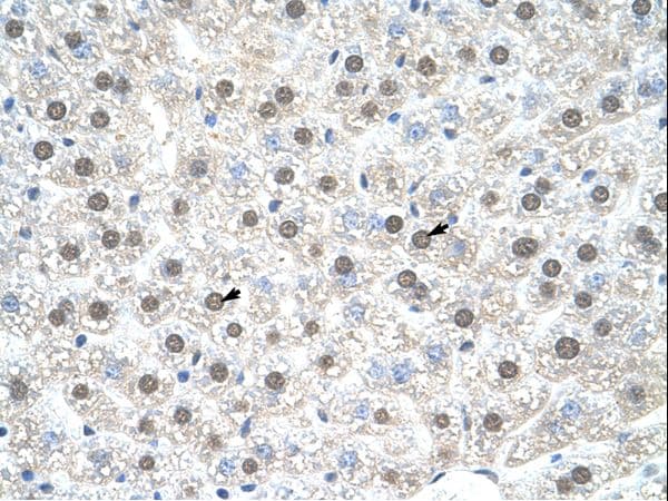 Polyclonal Rabbit anti-Mouse NR1I3 / CAR Antibody (C-Terminus, IHC, WB)