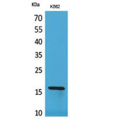 RBP2 / CRBPII Antibody (71-120 aa, Internal)