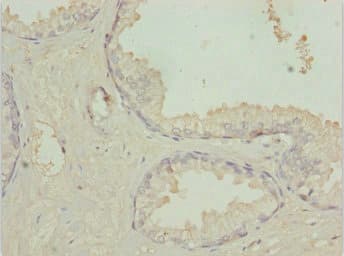 Polyclonal Rabbit anti-Human TM9SF1 Antibody (IHC, IF, WB)