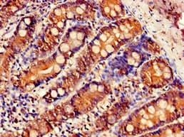 SLC5A1 / SGLT1 Antibody
