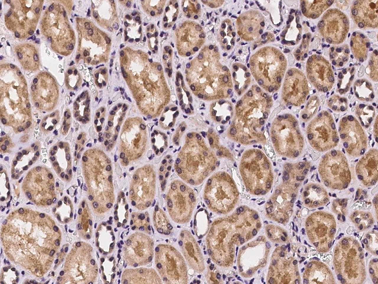 CRISPLD2 Antibody